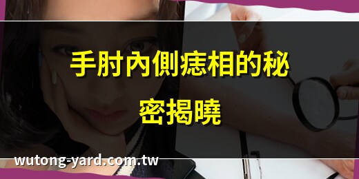 右手肘內側有痣